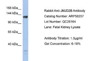 WB Suggested Anti-JMJD2B  Antibody Titration: 0. (KDM4B antibody  (Middle Region))