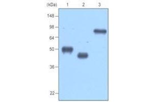 Recombinant protein MBP-tagged BCDEF, TPD52 and MAGEA3(each 20ng) were resolved by SDS-PAGE, transferred to PVDF membrane and probed with anti-MBP (1:1,000). (MBP antibody)