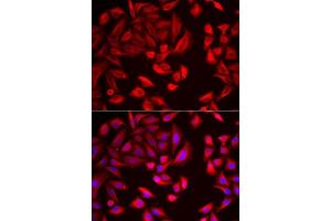 Immunofluorescence analysis of HeLa cells using CCT2 antibody. (CCT2 antibody  (AA 206-535))