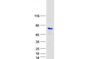 Validation with Western Blot (UBE2Q1 Protein (Myc-DYKDDDDK Tag))