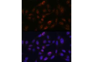 Immunofluorescence analysis of U2OS using SMC3 antibody (ABIN7270616) at dilution of 1:100. (SMC3 antibody)