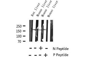 Western blot analysis of Phospho-EGFR (Ser1070) expression in various lysates (EGFR antibody  (pSer1070))