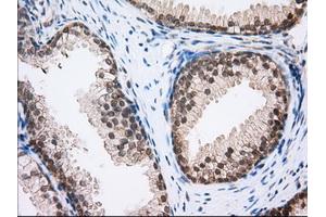 Immunohistochemical staining of paraffin-embedded Human Kidney tissue using anti-MTRF1L mouse monoclonal antibody.