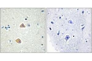 Immunohistochemistry analysis of paraffin-embedded human brain tissue, using EFNA5 Antibody. (Ephrin A5 antibody  (AA 31-80))