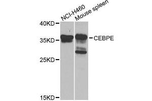 Western blot analysis of extracts of various cell lines, using CEBPE antibody. (CEBPE antibody  (AA 1-190))
