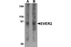 Western blot analysis of EVER2 in rat thymus tissue lysate with AP30324PU-N EVER2 antibody at (A) 1 and (B) 2 μg/ml.