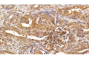 Immunohistochemistry (IHC) image for anti-Interleukin 17 (IL17) (AA 21-153) antibody (ABIN7427654)