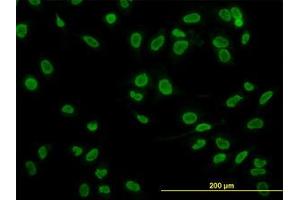 Image no. 2 for anti-TATA Box Binding Protein Associated Factor 11 (TAF11) (AA 158-211) antibody (ABIN598957) (TAF11 antibody  (AA 158-211))