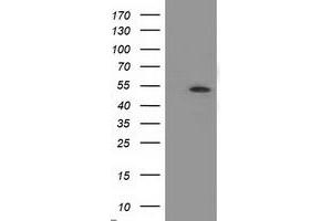 HEK293T cells were transfected with the pCMV6-ENTRY control (Left lane) or pCMV6-ENTRY APBB3 (Right lane) cDNA for 48 hrs and lysed. (APBB3 antibody)