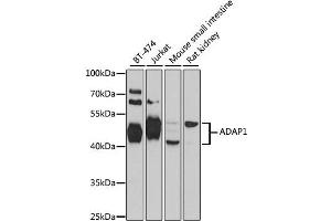Western blot analysis of extracts of various cell lines, using ADAP1 antibody (ABIN1870810) at 1:1000 dilution.
