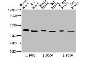 Western Blot Positive WB detected in: Mouse brain tissue, Rat brain tissue All lanes: OCT4 antibody at 1:1000, 1:5000, 1:8000 Secondary Goat polyclonal to Mouse IgG at 1/10000 dilution Predicted band size: 39, 31 kDa Observed band size: 45 kDa (OCT4 antibody  (AA 1-360))