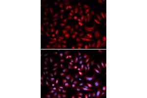 Immunofluorescence analysis of U2OS cells using PRKACB antibody (ABIN5973065). (PRKACB antibody)