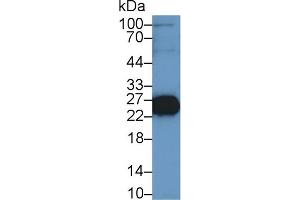 Western Blot; Sample: Mouse Skeletal muscle lysate; Primary Ab: 1µg/ml Rabbit Anti-Rat TNNI2 Antibody Second Ab: 0. (TNNI2 antibody  (AA 1-182))