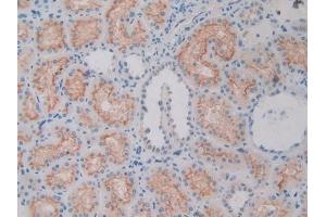 #VALUE! (APOL1 antibody  (AA 1-238))