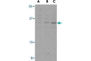 Western blot analysis of BCL2 in A-20 cell lysates with BCL2 polyclonal antibody  at (A) 1, (B) 2, and (C) 4 ug/mL .