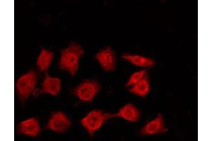 ABIN6272324 staining K562 by IF/ICC. (CBX3 antibody  (Internal Region))