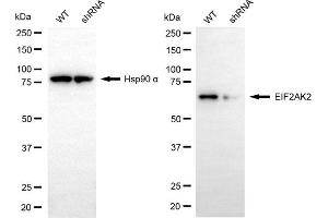 Western blotting analysis using EIF2AK2 antibody (ABIN7798506). (EIF2AK2 antibody)