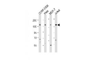 All lanes : Anti-PLCG1 Antibody (Center) at 1:2000 dilution Lane 1: CCRF-CEM whole cell lysates Lane 2: Hela whole cell lysates Lane 3: MCF-7 whole cell lysates Lane 4: Jurkat whole cell lysates Lysates/proteins at 20 μg per lane. (Phospholipase C gamma 1 antibody  (AA 456-488))