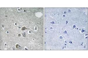 Immunohistochemistry (IHC) image for anti-Fibulin 2 (FBLN2) (AA 241-290) antibody (ABIN2890318) (FBLN2 antibody  (AA 241-290))