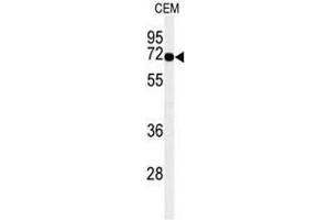 Western blot analysis of MFSD6 Antibody (C-term) in CEM cell line lysates (35µg/lane). (MFSD6 antibody  (C-Term))