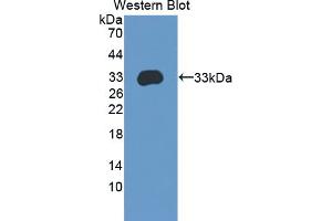 Figure. (APBA3 antibody  (AA 261-506))