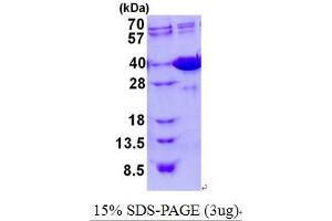 Galectin 4 (LGALS4) (AA 1-326) (Active) protein (His tag)