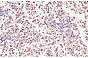 Immunohistochemistry of paraffin-embedded Human appendix using SNRNP70 Polyclonal Antibody at dilution of 1:100 (40x lens).