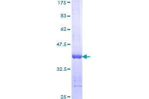 Spectrin Repeat Containing, Nuclear Envelope 1 (SYNE1) (AA 1561-1670) protein (GST tag)
