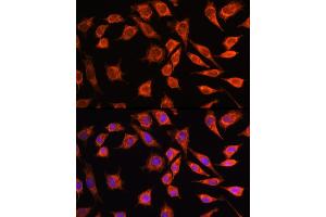 Immunofluorescence analysis of L929 cells using MRPL45 Rabbit pAb (ABIN6133218, ABIN6144020, ABIN6144021 and ABIN6217105) at dilution of 100 (40x lens). (MRPL45 antibody  (AA 57-306))