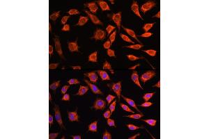 Immunofluorescence analysis of L929 cells using MRPL45 Rabbit pAb (ABIN6133218, ABIN6144020, ABIN6144021 and ABIN6217105) at dilution of 100 (40x lens).