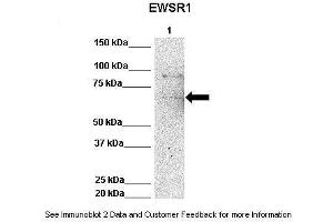 Lanes:   Lane 1: 50ug Hela Lysate  Primary Antibody Dilution:   1:1000  Secondary Antibody:   Anti-rabbit-HRP  Secondary Antibody Dilution:   1:10,000  Gene Name:   EWSR1  Submitted by:   Archa Fox, University of Western Australia  EWSR1 is strongly supported by BioGPS gene expression data to be expressed in Human HeLa cells (EWSR1 antibody  (Middle Region))