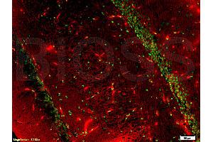 Formalin-fixed and paraffin embedded rat brain tissue labeled with Anti-BrdU(A7) Monoclonal Antibody, FITC Conjugated (ABIN706721) at 1:200 for 40 minutes at 37°C followed by labeling Rabbit Anti-Tubulin Beta, Cy3 conjugated 1:200, 40 minutes at 37°C (TUBB antibody  (AA 61-160))