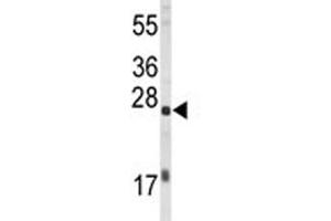 Western Blotting (WB) image for anti-Eukaryotic Translation Initiation Factor 4E (EIF4E) antibody (ABIN3030891)