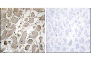 Immunohistochemistry analysis of paraffin-embedded human heart tissue, using Collagen V alpha1 Antibody. (COL5A1 antibody  (AA 301-350))