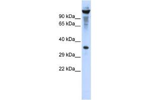 WB Suggested Anti-RNASET2 Antibody Titration:  0. (RNASET2 antibody  (Middle Region))