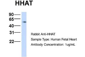 Western Blotting (WB) image for anti-Hedgehog Acyltransferase (HHAT) (N-Term) antibody (ABIN2782948)