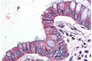 Human Colon (formalin-fixed, paraffin-embedded) stained with GPR116 antibody ABIN399995 at 10 ug/ml followed by biotinylated goat anti-rabbit IgG secondary antibody ABIN481713, alkaline phosphatase-streptavidin and chromogen. (G Protein-Coupled Receptor 116 antibody  (Internal Region))