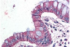 Human Colon (formalin-fixed, paraffin-embedded) stained with GPR116 antibody ABIN399995 at 10 ug/ml followed by biotinylated goat anti-rabbit IgG secondary antibody ABIN481713, alkaline phosphatase-streptavidin and chromogen.