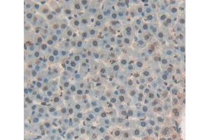 IHC-P analysis of liver tissue, with DAB staining. (THYN1 antibody  (AA 1-226))