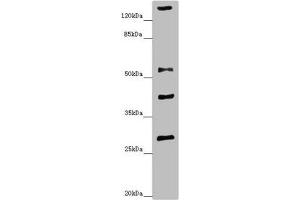 Western blot All lanes: ZSCAN26antibody at 1.