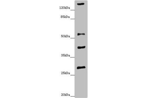 ZNF187 antibody  (AA 239-478)