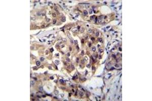 anti-hCG_1995004 (AA 113-144), (Middle Region) antibody