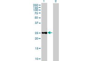 Western Blot analysis of CTRB1 expression in transfected 293T cell line by CTRB1 MaxPab polyclonal antibody.