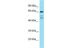 Western Blotting (WB) image for anti-Fidgetin-Like 2 (FIGNL2) (Middle Region) antibody (ABIN2791546) (Fidgetin-Like 2 antibody  (Middle Region))