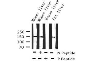 Western blot analysis of Phospho-EGFR (Tyr1197) expression in various lysates (EGFR antibody  (pTyr1197))