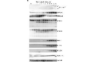 Western blot validation of host protein regulation. (ISG15 antibody)