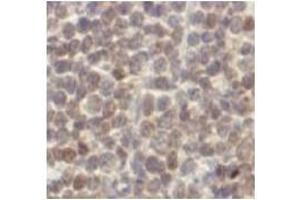Immunohistochemistry (IHC) image for anti-Cyclin D1 (CCND1) antibody (ABIN1106871) (Cyclin D1 antibody)