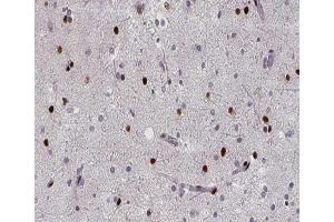 ABIN6267394 at 1/200 staining human brain tissue sections by IHC-P. (RPA2 antibody  (pThr21))