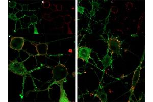 Live cell imaging of ω-Conotoxin MVIIC-ATTO Fluor-647N in differentiated  cells.