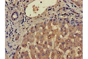 Immunohistochemistry of paraffin-embedded human liver tissue using ABIN7145926 at dilution of 1:100 (CCR3 antibody  (AA 306-355))